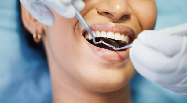 Best Urgent Care for Lost Fillings or Crowns in Princeton, TX